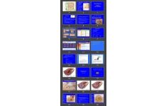 پاورپوینت Hyperlipidemia