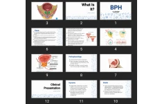 پاورپوینت BPH