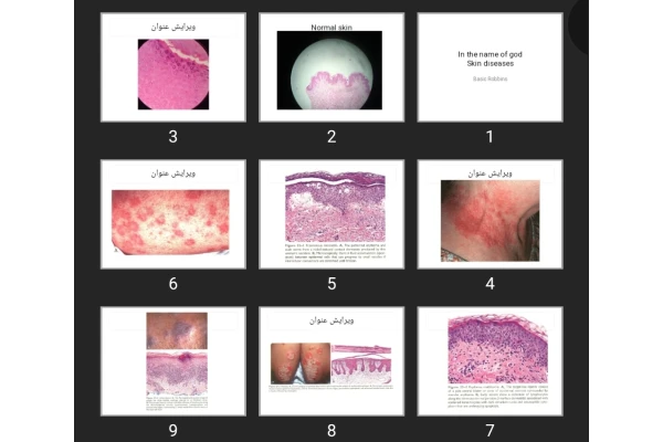 پاورپوینت Skin diseases