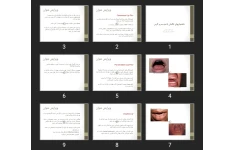 پاورپوینت ناهنجاری های تکاملی ناحیه سر و گردن