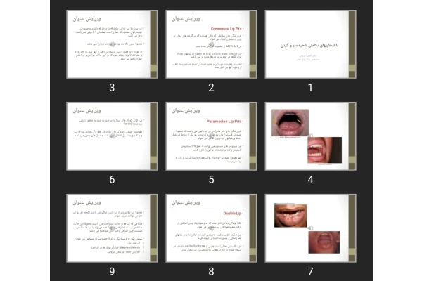 پاورپوینت ناهنجاری های تکاملی ناحیه سر و گردن