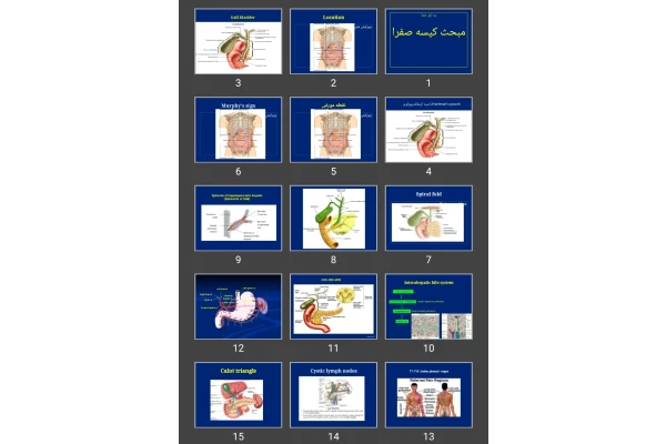 پاورپوینت مبحث کیسه صفرا