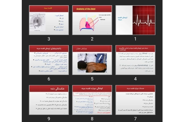 پاورپوینت ترومای قفسه سینه