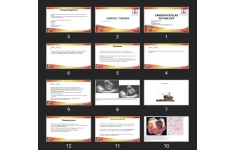 پاورپوینت CARDIOVASCULAR PATHOLOGY