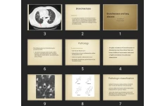 پاورپوینت Bronchiectasis and lung abscess