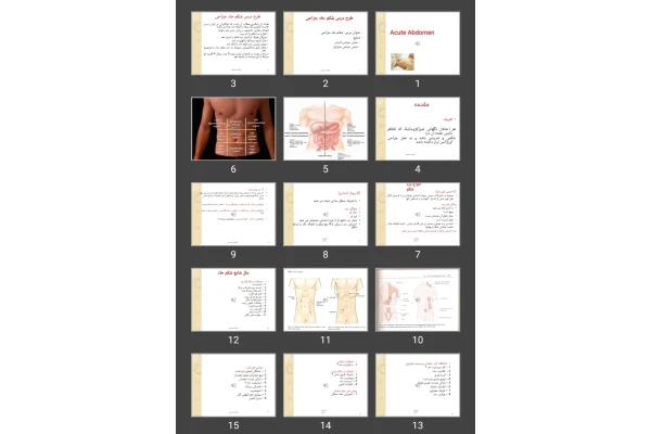 پاورپوینت شکم حاد Acute Abdomen