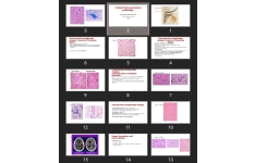 پاورپوینت Central Nervous System pathology