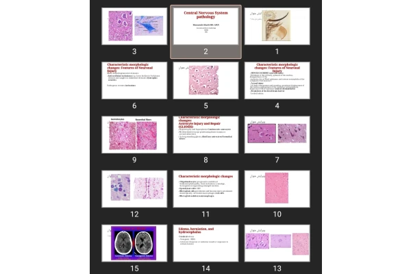 پاورپوینت Central Nervous System pathology