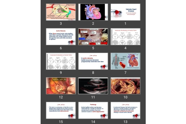 پاورپوینت اندوکاردیت Valvular Heart Disease