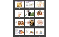 پاورپوینت Diencephalon