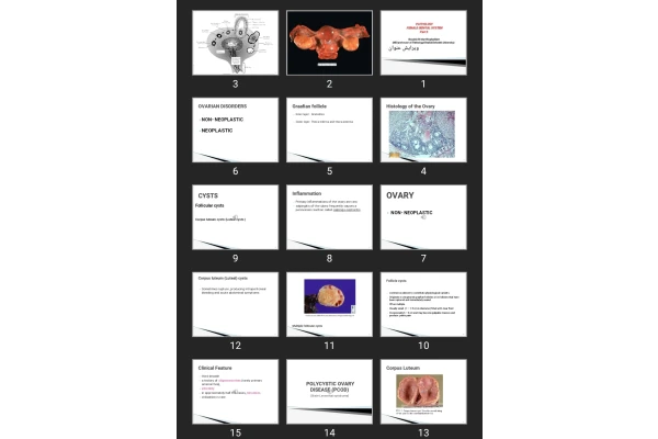 پاورپوینت PATHOLOGY FEMALE GENITAL SYSTEM Part 3
