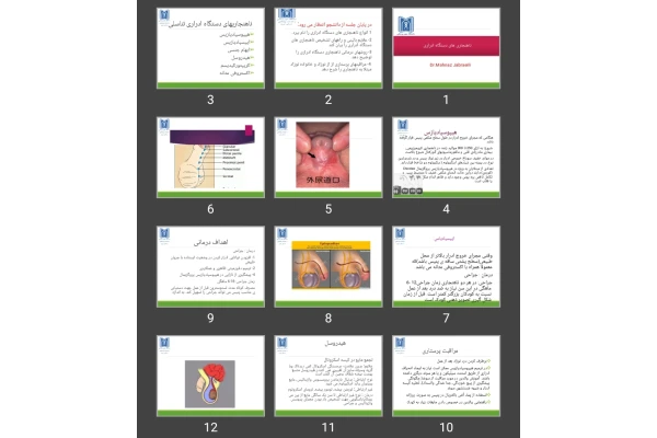 پاورپوینت ناهنجاری های دستگاه ادراری