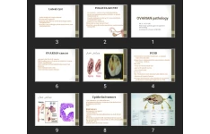 پاورپوینت OVARIAN pathology