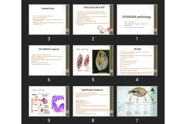 پاورپوینت OVARIAN pathology