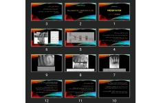 پاورپوینت رادیولوژی دندانپزشکی RadiOLOGY