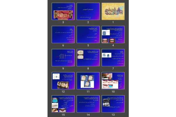 پاورپوینت ترمیم های کامپوزیتی