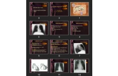 پاورپوینت Cardiac Diagnostic Testing