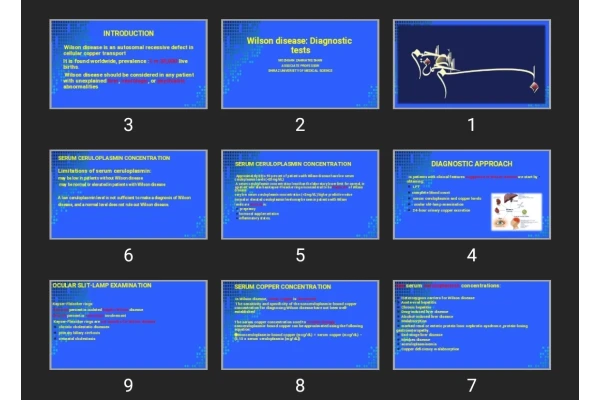 پاورپوینت Wilson disease: Diagnostic tests