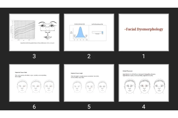 پاورپوینت Facial Dysmorphology