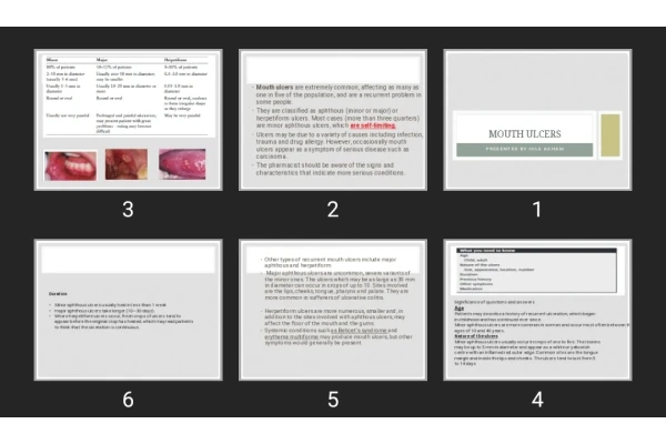 پاورپوینت زخم دهانی Mouth ulcers