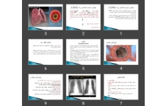 پاورپوینت بیماری مزمن انسدادی ریه copd