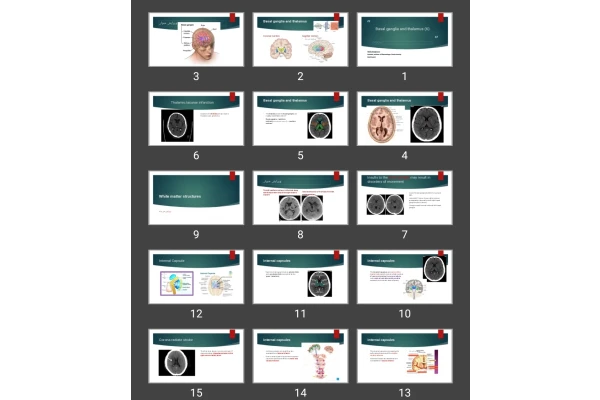 پاورپوینت بازال گانگلیا و حفره خلفی Basal ganglia and thalamus