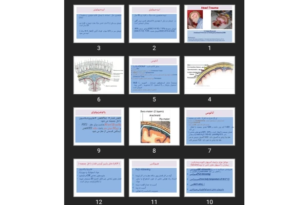 پاورپوینت ترومای سر