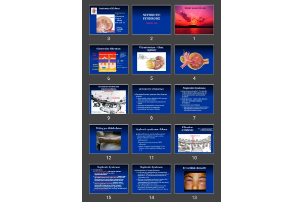 پاورپوینت NEPHROTIC SYNDROME