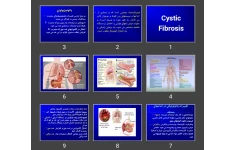 پاورپوینت فيبروكيستيک (Cystic Fibrosis)