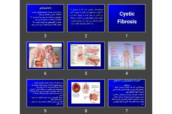 پاورپوینت فيبروكيستيک (Cystic Fibrosis)