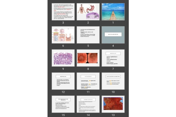 پاورپوینت NON-NEOPLASTIC DISEASE OF THE STOMACH