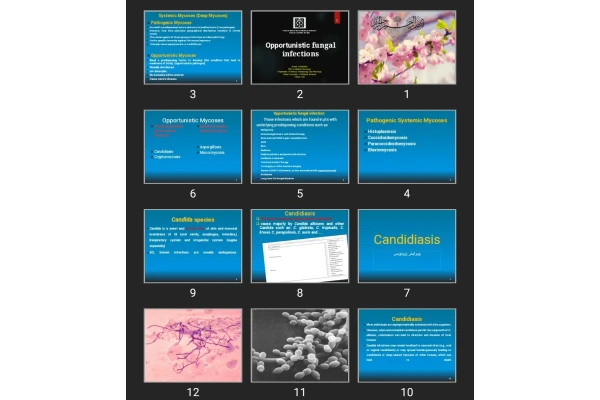 پاورپوینت Opportunistic fungal infections