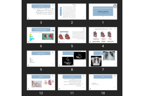 پاورپوینت cardiomyopathy