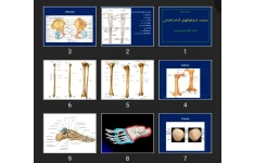 پاورپوینت مبحث استخوان های اندام تحتانی