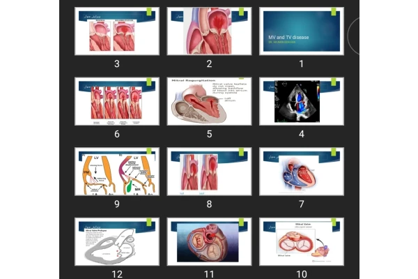 پاورپوینت MV and TV disease