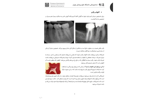 جزوه کمپلکس پالپ و پری‌اپیکال - بیماری‌های پالپ: یافته‌های هیستولوژیک، کلینیکی و رادیوگرافیک