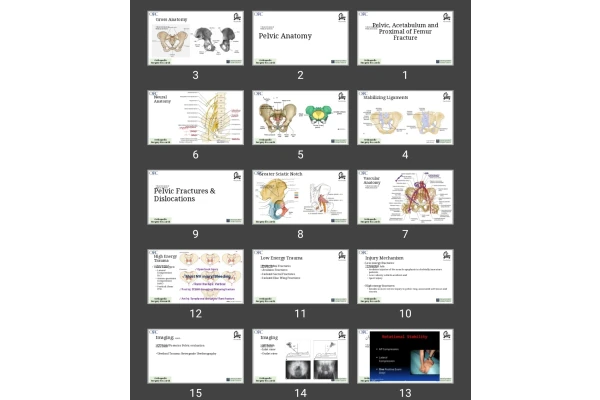 پاورپوینت شکستگی لگن، استابولوم و سر فنور Pelvic, Acetabulum and Proximal of Femur Fracture