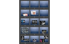 پاورپوینت فصل پنجم تکنیک های سونوگرافی رادیولوژی و سونوگرافی برای مامایی