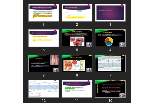 پاورپوینت Acute Rheumatic Fever