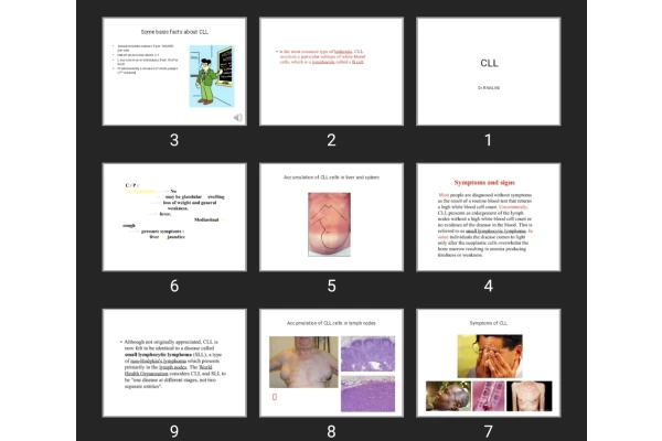 پاورپوینت CLL