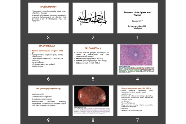 پاورپوینت Disorders of the Spleen and Thymus
