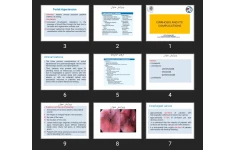 پاورپوینت CIRRHOSIS AND ITS COMPLICATIONS
