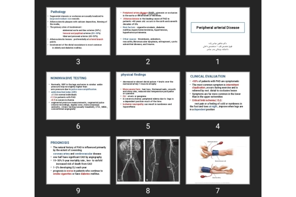 پاورپوینت Peripheral arterial Disease