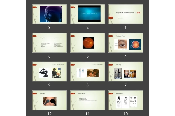 پاورپوینت Physical examination of EYE