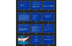 پاورپوینت Gout Crystal arthropathy