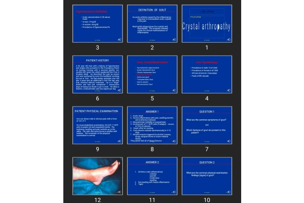 پاورپوینت Gout Crystal arthropathy