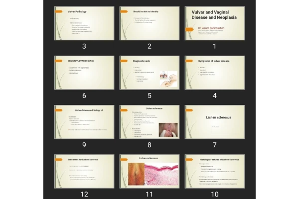 پاورپوینت بیماری و نئوپلازی ولو و واژن Vulvar and Vaginal Disease and Neoplasia