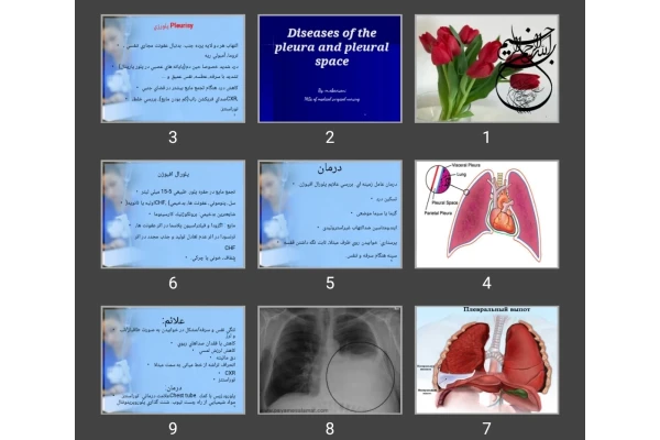 پاورپوینت پلور شغلی Diseases of the pleura and pleural space