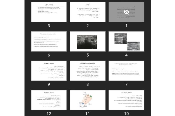 پاورپوینت Goiter گواتر