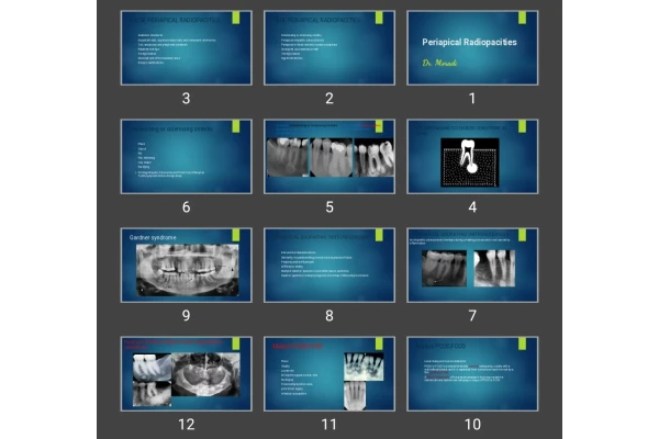 پاورپوینت Periapical Radiopacities